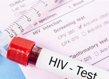 تشخیص و درمان HIV رایگان است